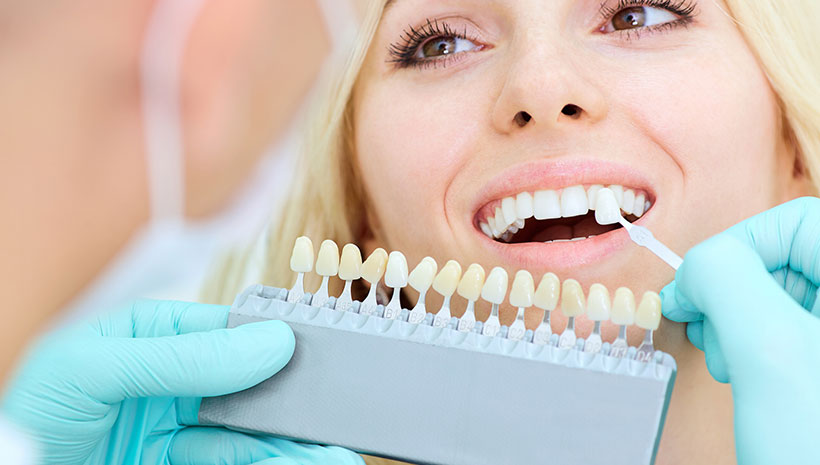 Cosmetic Dentist | Polaris Family Dental - Veneers - Crowns