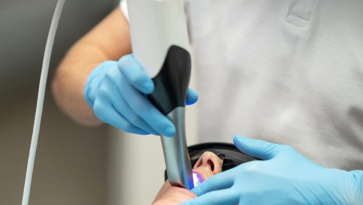 iTero® Digital Scanning in Lewis Center